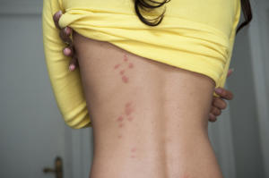 Sustaining a Mattress Bug-Free Facility